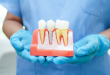 5 Ways Periodontics And Implant Dentistry Improve Oral Health