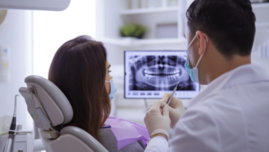 5 Benefits Of Routine X Rays In General Dental Care
