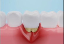 Why Collaboration Between Periodontists And General Dentists Matters